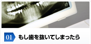 01.もし歯を抜いてしまったら