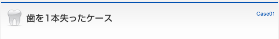 歯を1本失ったケース